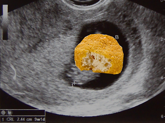Nugget-utero